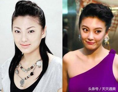 割单眼皮的明星,揭秘美丽背后的故事